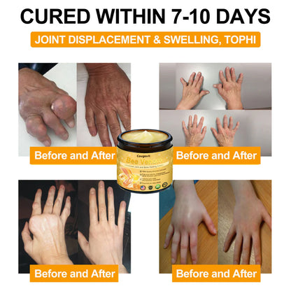 🔥Christmas Special： Limited Time 50% OFF🔥Bee Venom Advanced Joint and Bone Healing Cream