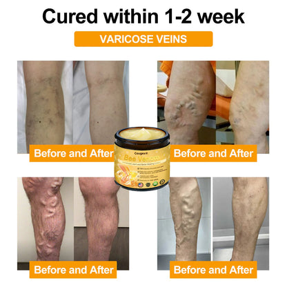 🔥Christmas Special： Limited Time 50% OFF🔥Bee Venom Advanced Joint and Bone Healing Cream