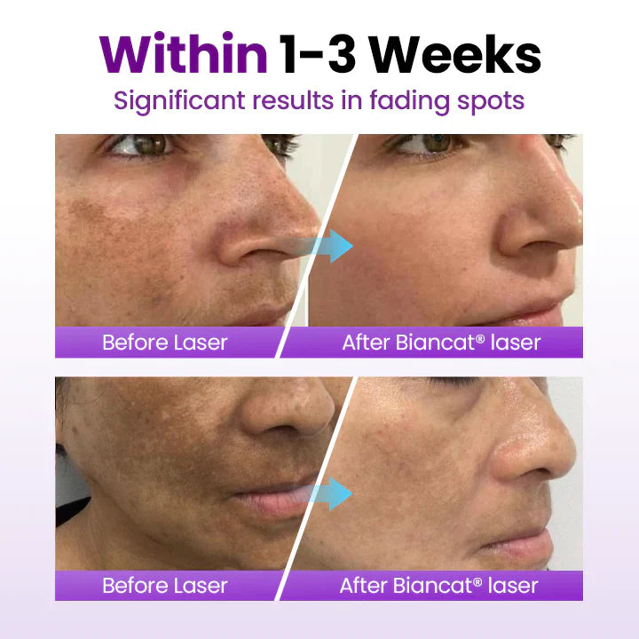 🔥SpotErase Probiotic Shield Serum