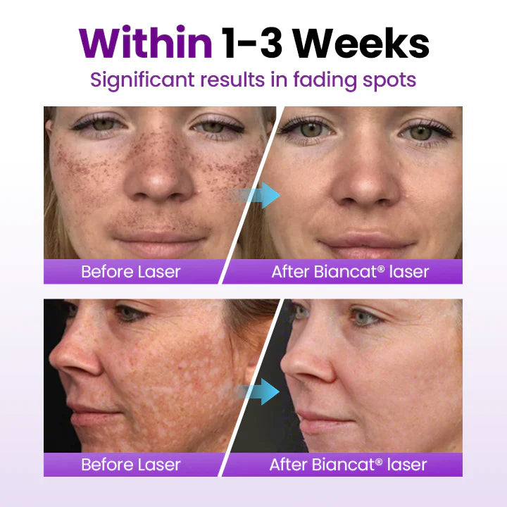 🔥SpotErase Probiotic Shield Serum