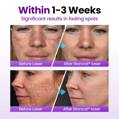 🔥SpotErase Probiotic Shield Serum