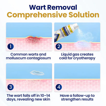 Timilk® ChillErase Bump Renewal Spray