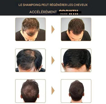✨Anti-hair loss shampoo, hair root activator