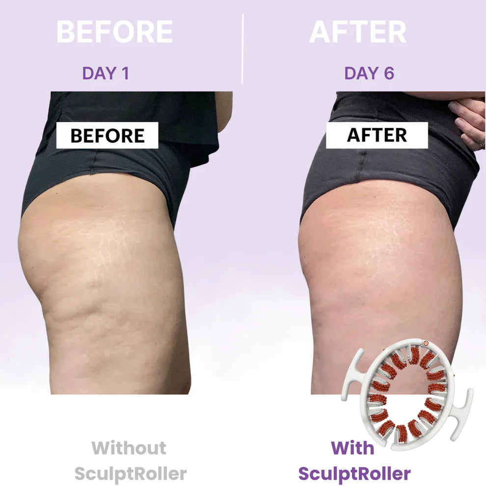 🔥Limited Time 50% OFF🔥 Cellulite Muscle Massager Roller for Men & Women | High-Density Polypropylene Skin Friendly Material |