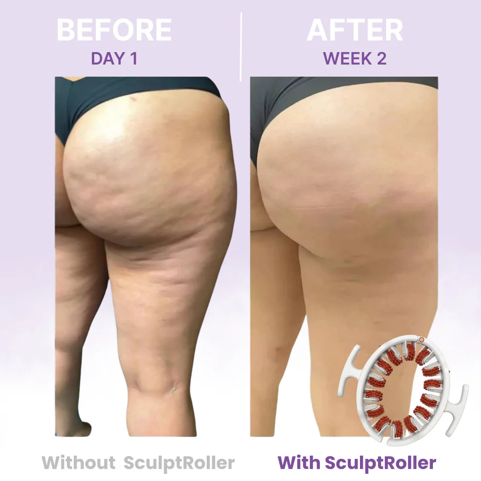 🔥Limited Time 50% OFF🔥 Cellulite Muscle Massager Roller for Men & Women | High-Density Polypropylene Skin Friendly Material |