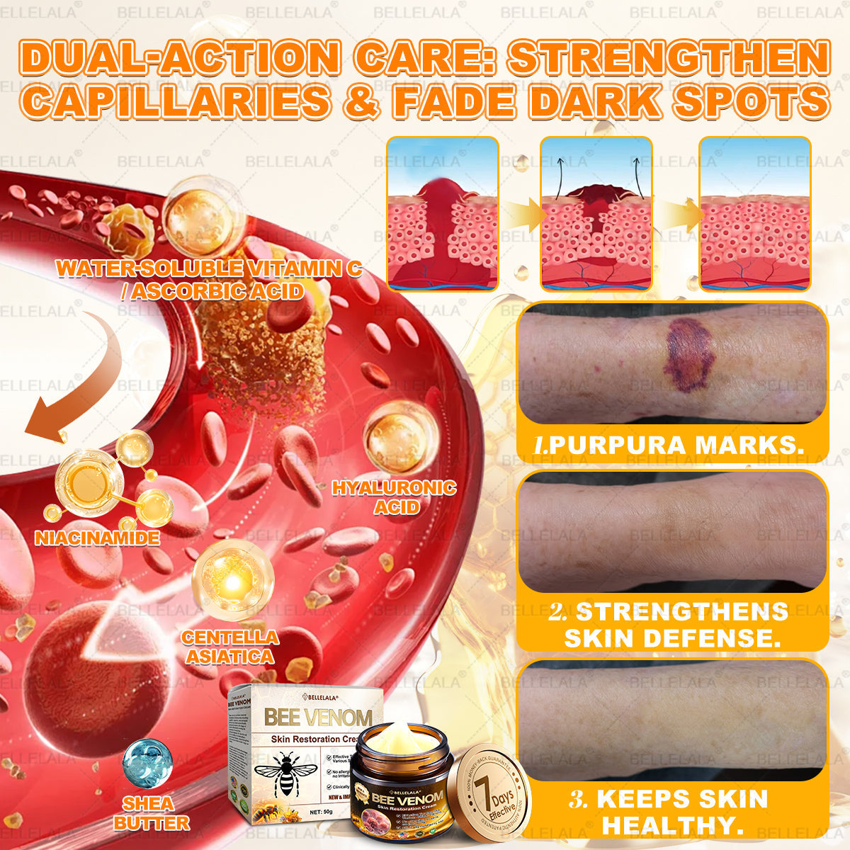 Hot Save 🥇 𝖡𝖾𝖾 𝗏𝖾𝗇𝗈𝗆 𝖲𝗄𝗂𝗇 𝖱𝖾𝗌𝗍𝗈𝗋𝖺𝗍𝗂𝗈𝗇 𝖢𝗋𝖾𝖺𝗆