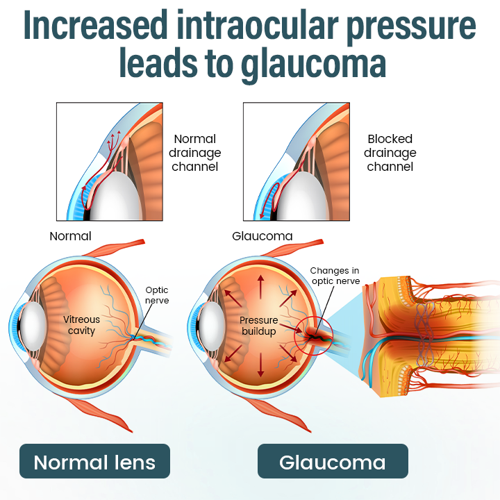 Timilk® OptiFusion Nano Eye Drops Serum