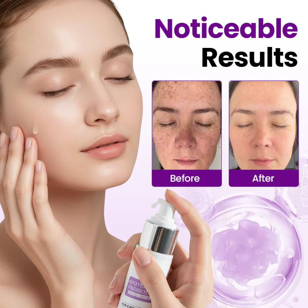 🔥SpotErase Probiotic Shield Serum