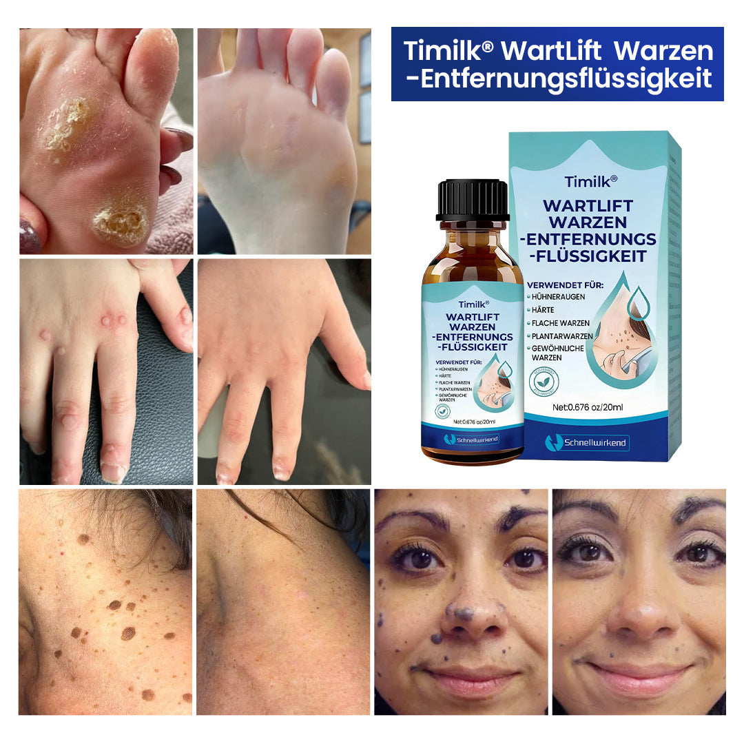 Timilk® WartLift Wart Removal Fluid⚕️