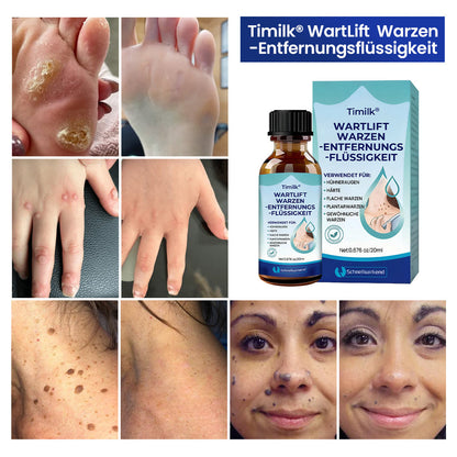 Timilk® WartLift Wart Removal Fluid⚕️