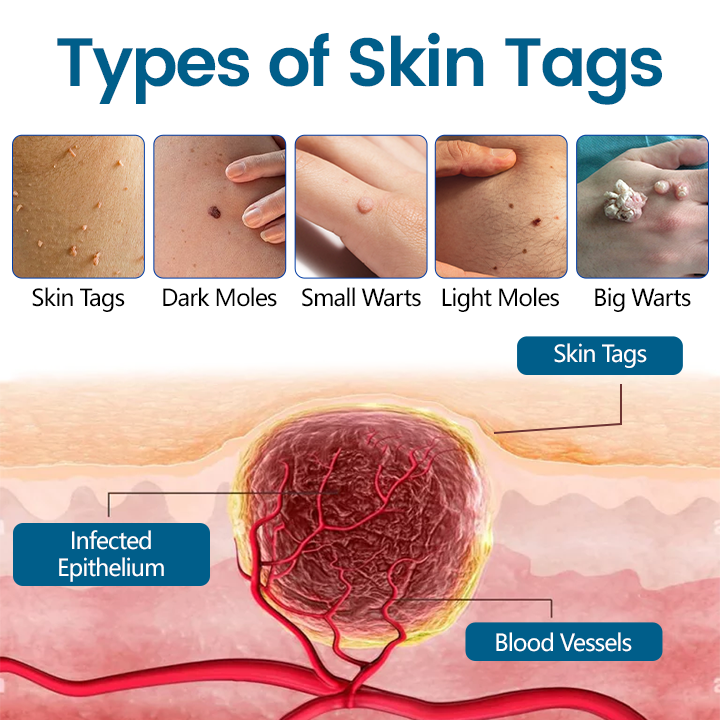 Timilk® DermaVenom RX+ Precision Removal Cream