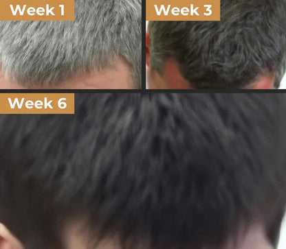 🔥First 100 :2nd ltem 60% Off🔥Gray Gone Bar Shampoo