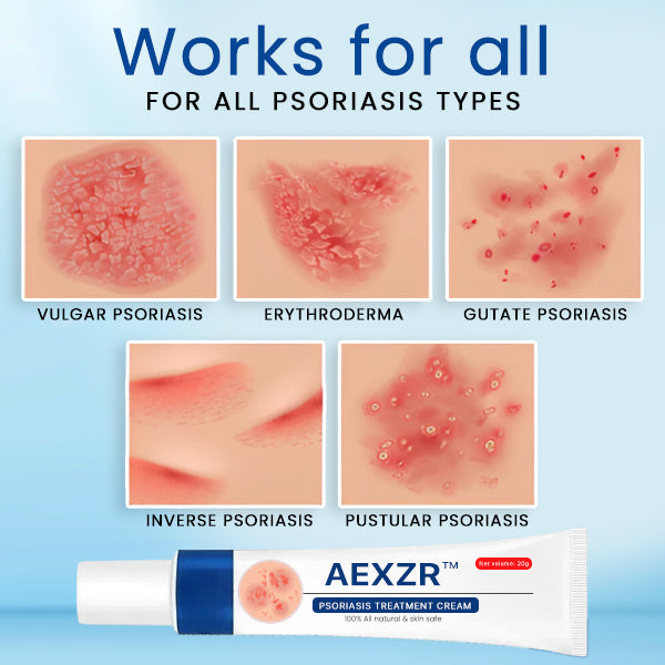 AEXZR™ Psoriasis Treatment Cream🌿 Dermatologist-Developed Herbal Formula: Targets Inflammation at The Root for Lasting Relief.