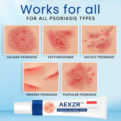 AEXZR™ Psoriasis Treatment Cream🌿 Dermatologist-Developed Herbal Formula: Targets Inflammation at The Root for Lasting Relief.